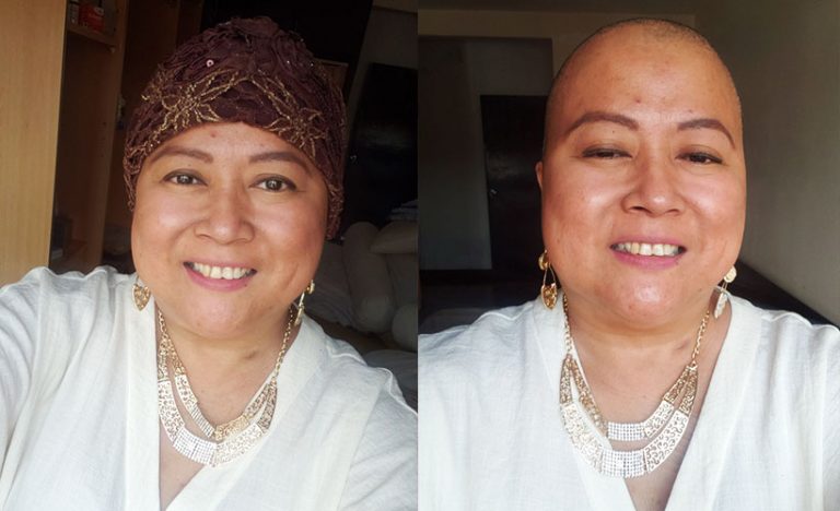 Margaret Rose: How I’m Beating Breast Cancer